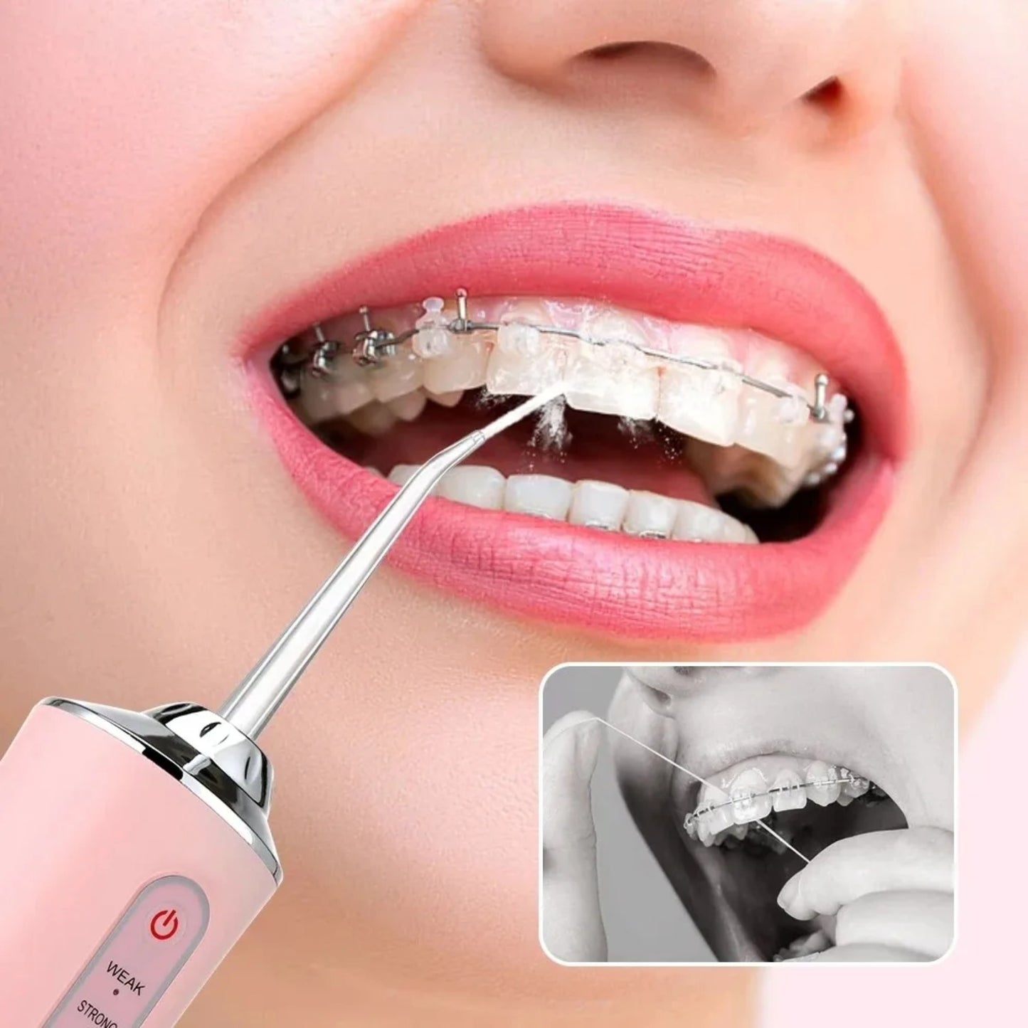 Limpiador Dental Electrico Irrigador